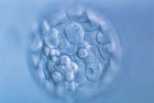 赴美试管专题：降低胚胎碎片 也是提升试管成功率的关键